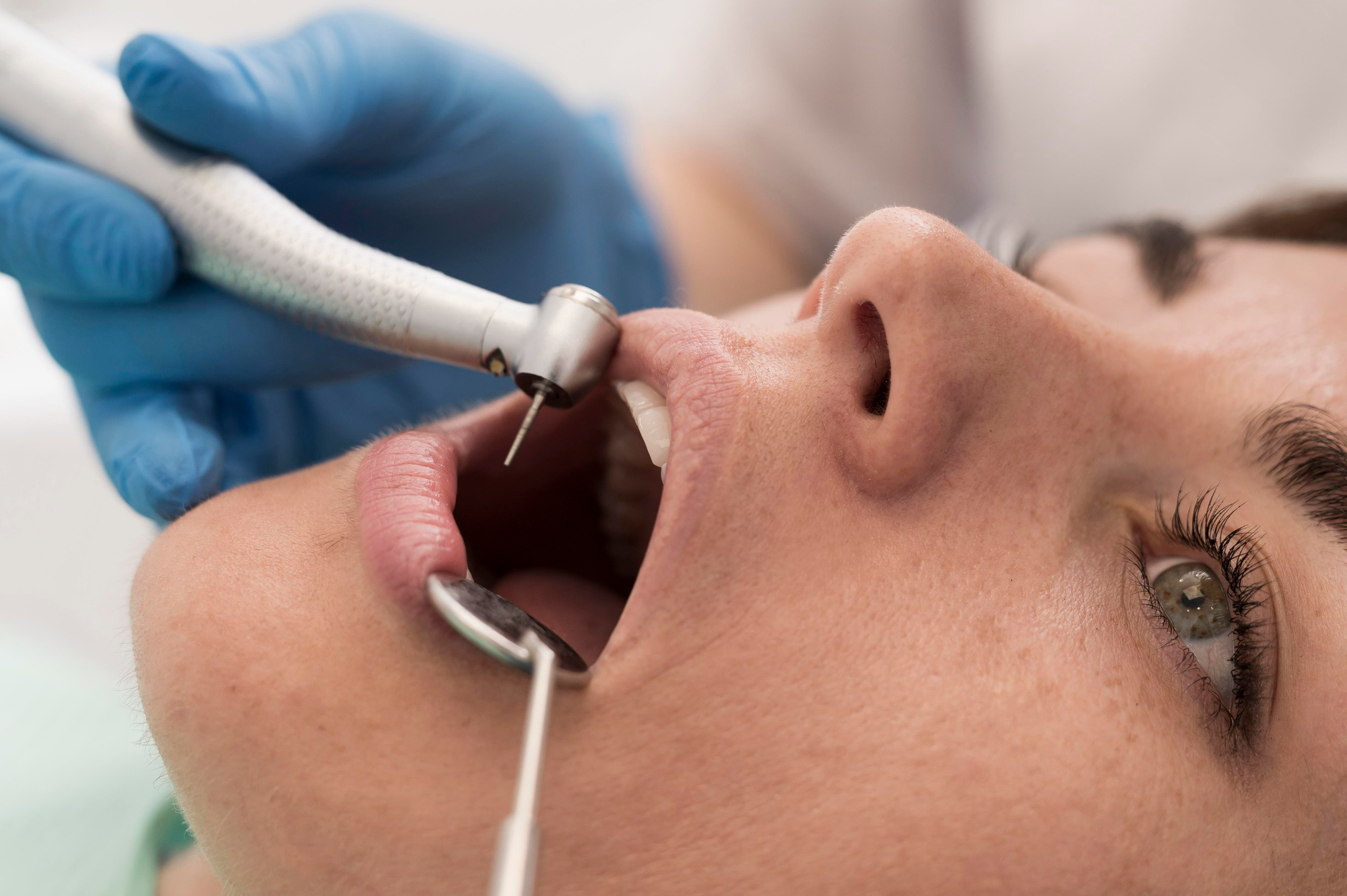 Full Mouth Rehabilitations